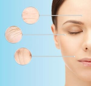 Botox,naturally occurring,liquid facelift,nose,laugh lines