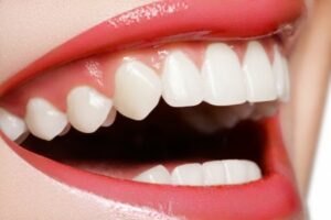 Lip Augmentation, Procedure, Lip enhancement,Surgery,Advanced Liposuction Center